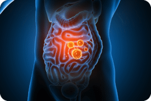 Representação digital 3D do sistema digestório humano em um corpo translúcido azul. O intestino, especificamente o intestino delgado e parte do grosso, está em destaque com áreas avermelhadas e pontos luminosos amarelados, que podem simbolizar inflamação, microrganismos ou nutrientes, remetendo à saúde intestinal.